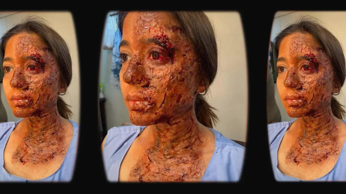 Prosthetic Work portfolio page 5