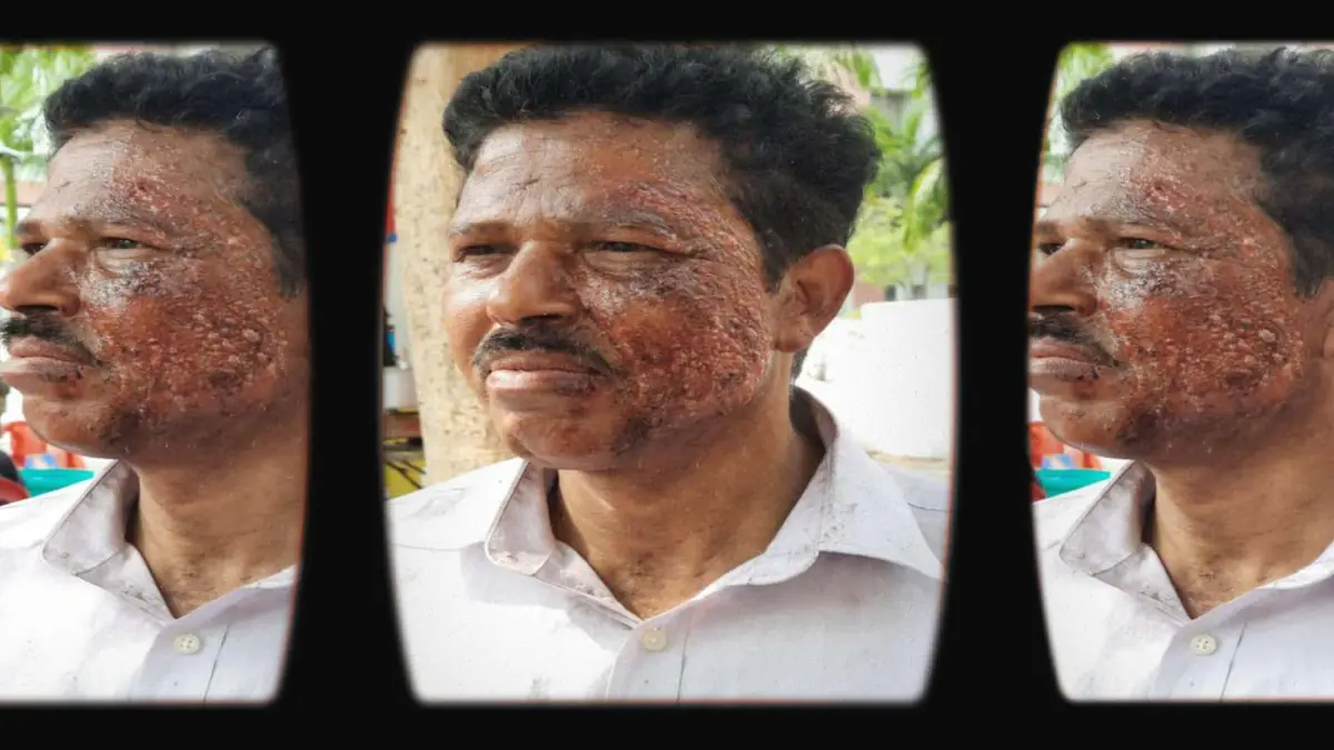 Prosthetic Work portfolio page 6