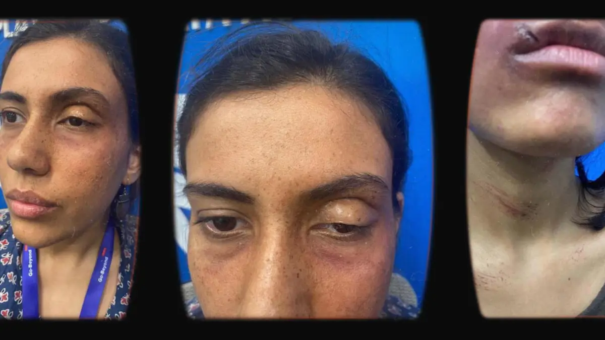 Prosthetic Work portfolio page 9