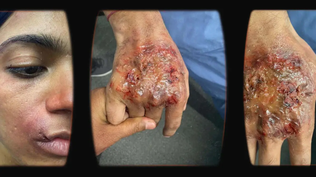 Prosthetic Work portfolio page 10