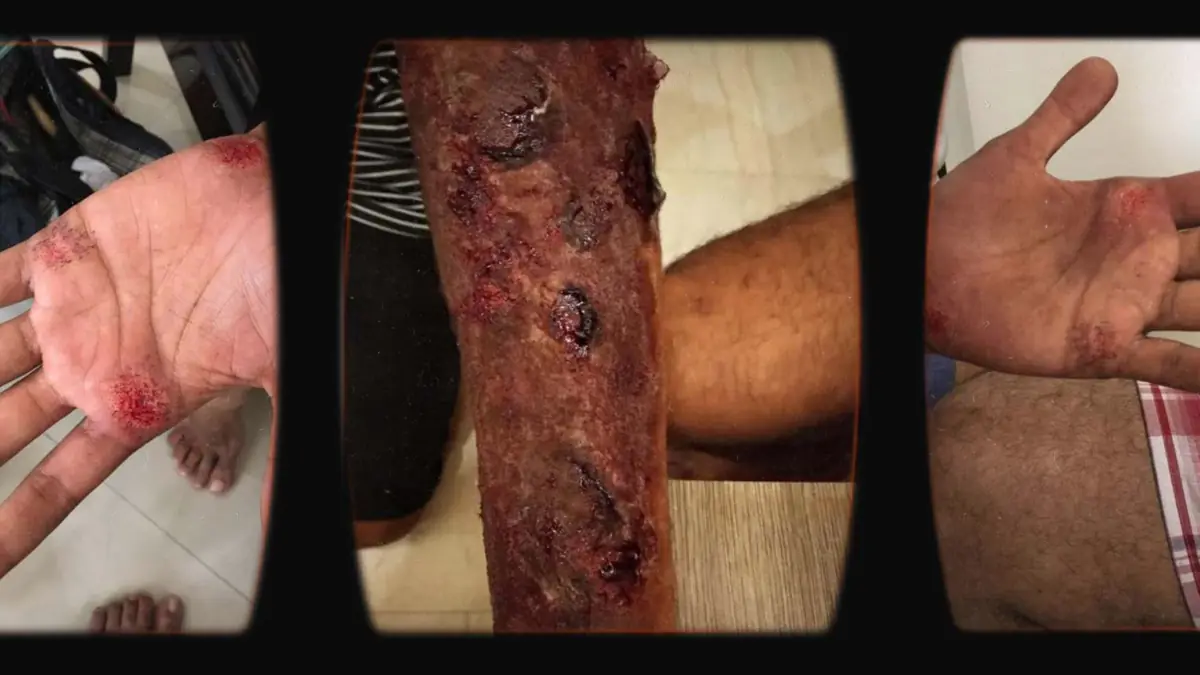 Prosthetic Work portfolio page 12