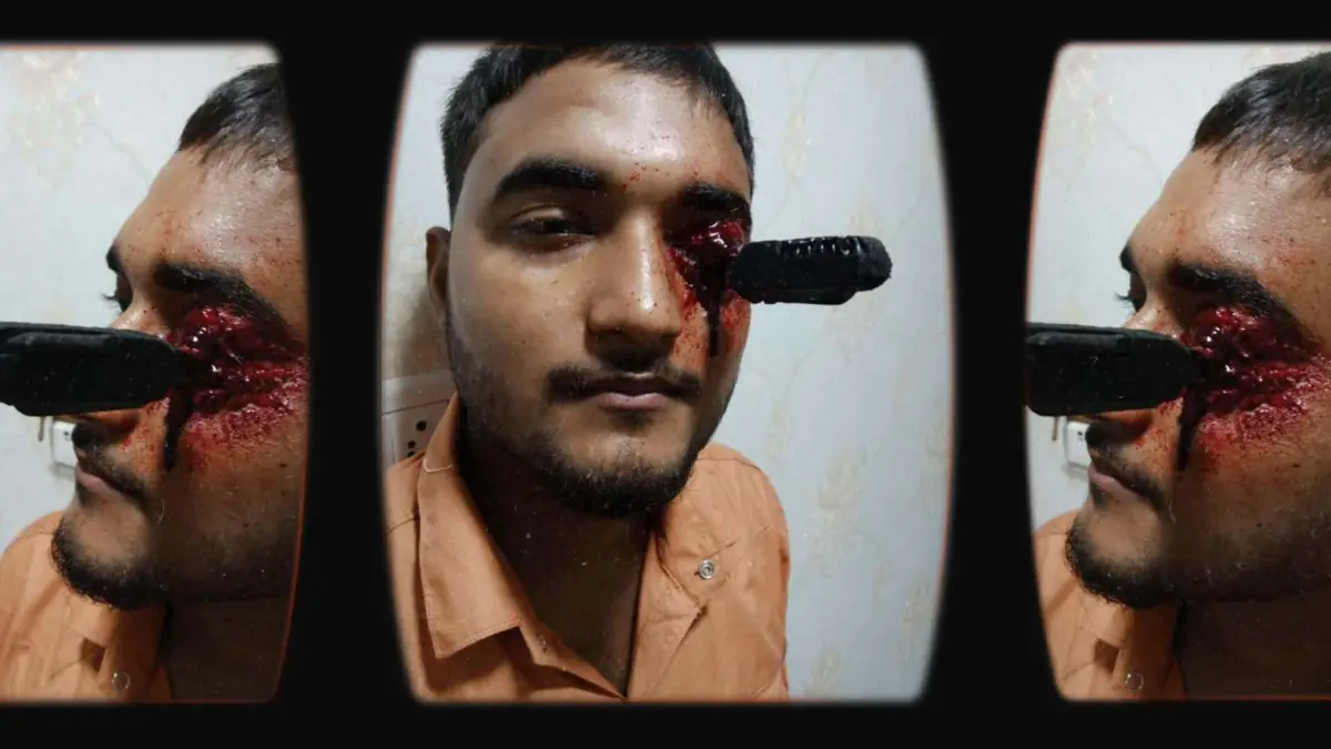 Prosthetic Work portfolio page 14