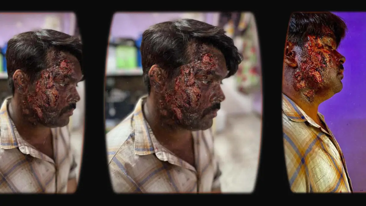 Prosthetic Work portfolio page 15