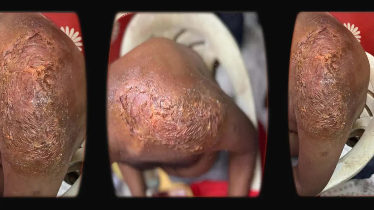 Prosthetic Work portfolio page 16