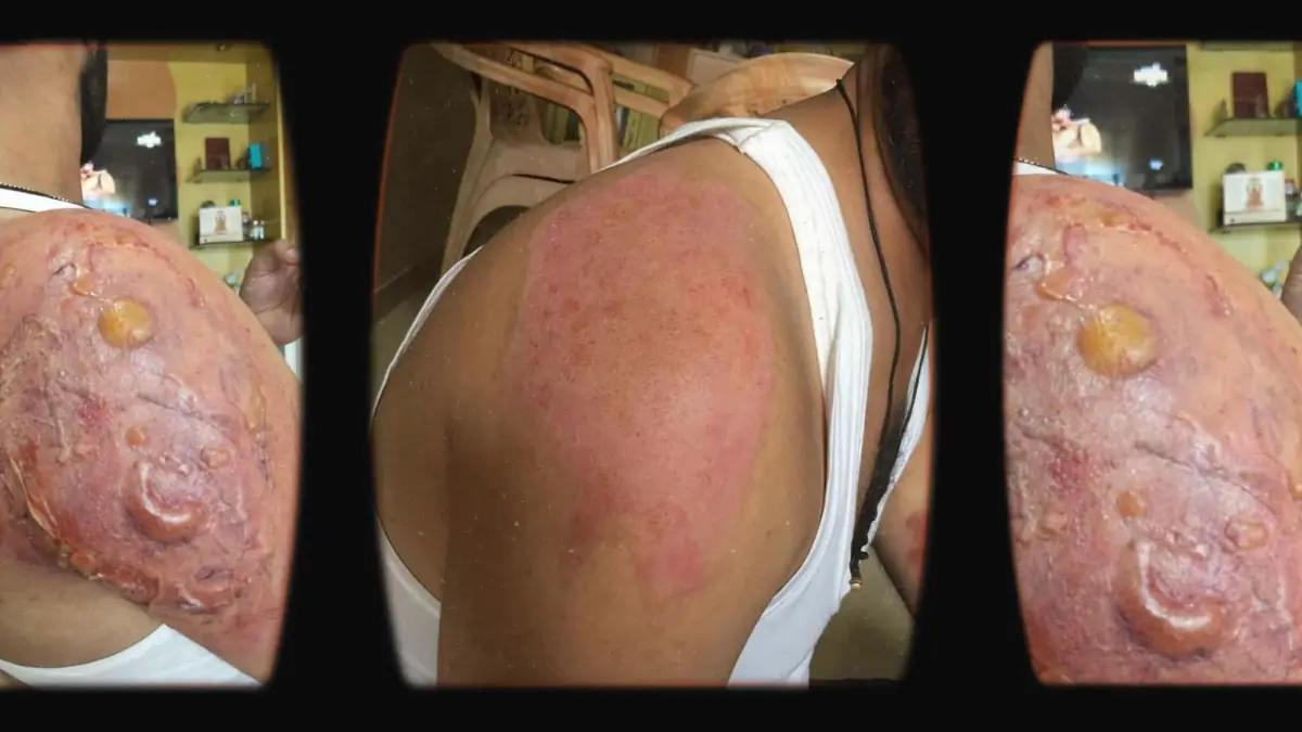 Prosthetic Work portfolio page 17