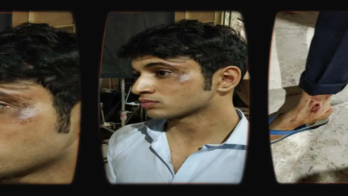 Prosthetic Work portfolio page 19