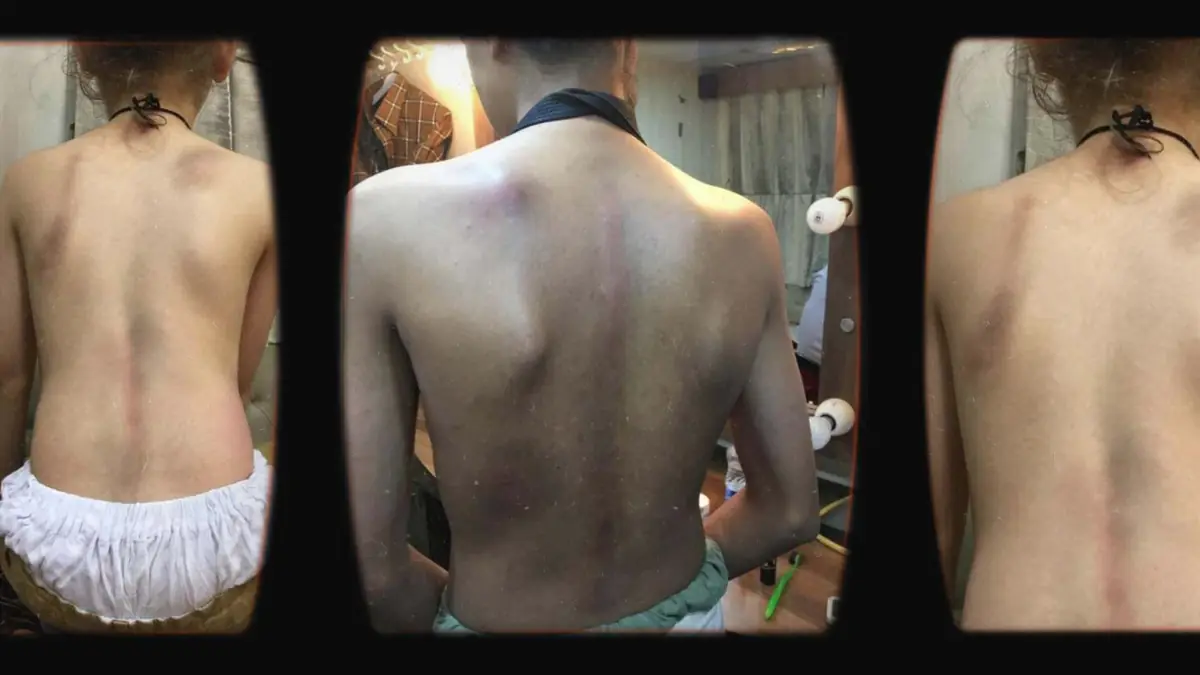 Prosthetic Work portfolio page 21