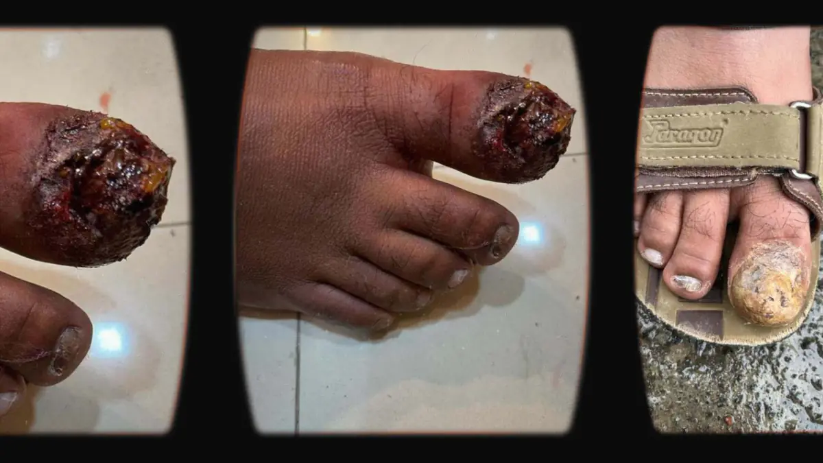 Prosthetic Work portfolio page 23