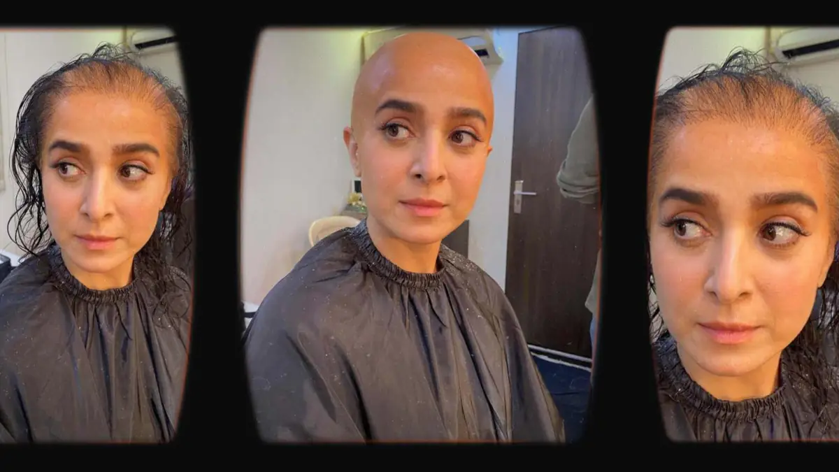 Prosthetic Work portfolio page 25