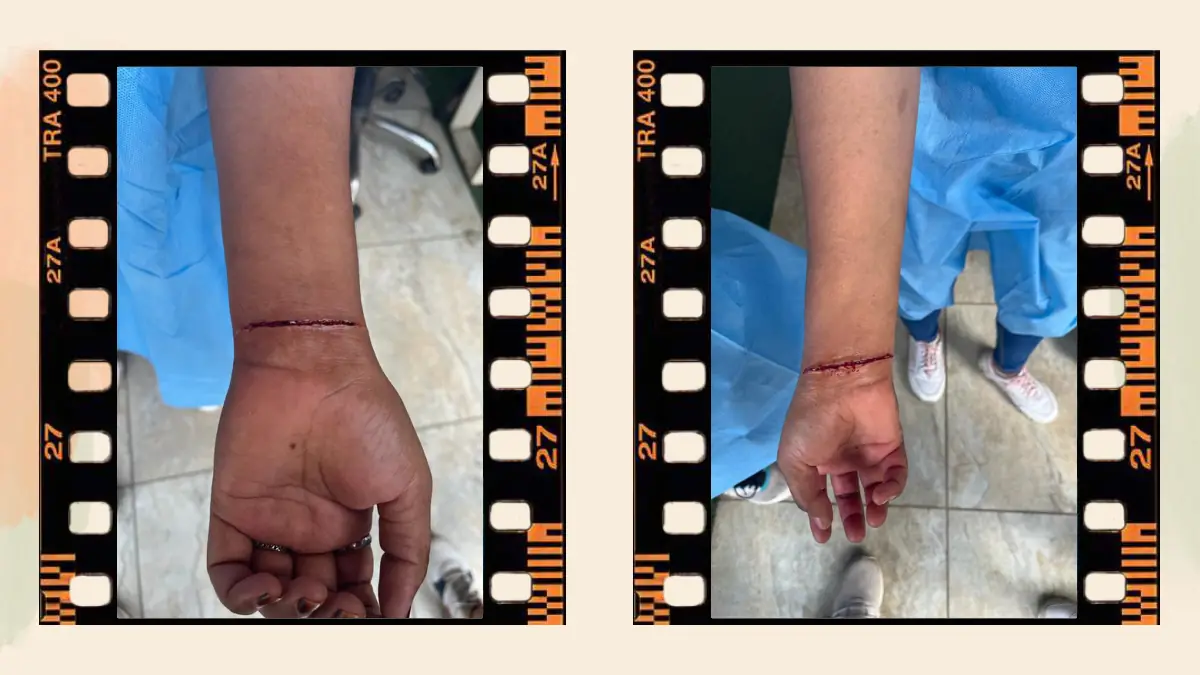 Prosthetic Work portfolio page 36