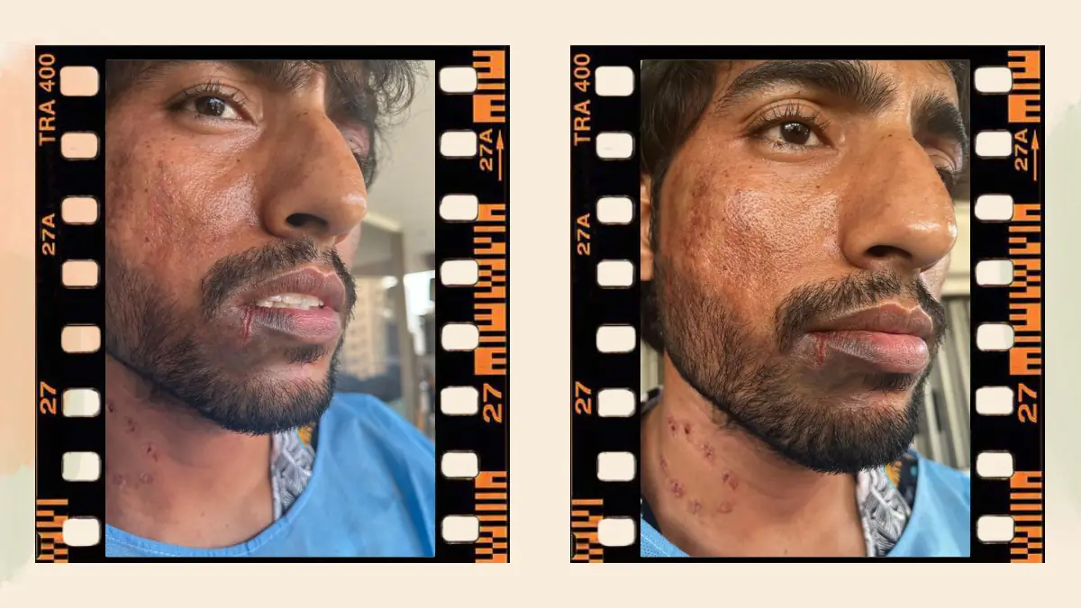 Prosthetic Work portfolio page 38