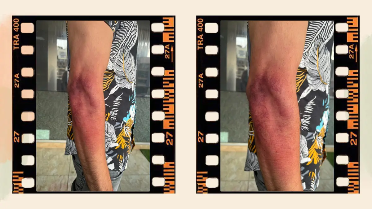 Prosthetic Work portfolio page 40