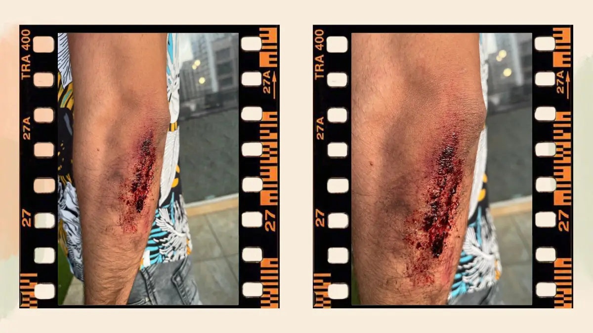 Prosthetic Work portfolio page 41