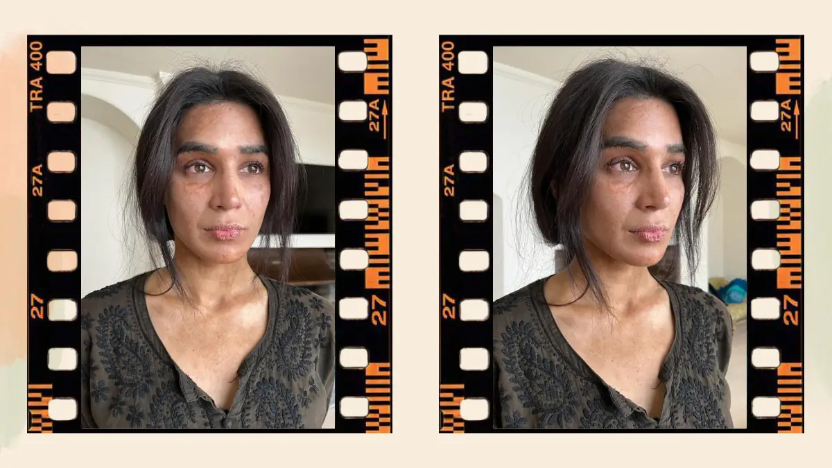 Prosthetic Work portfolio page 43