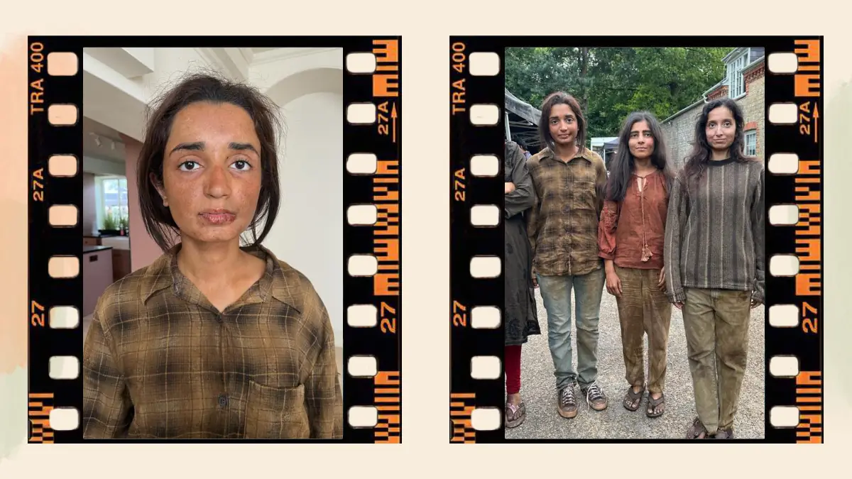 Prosthetic Work portfolio page 45