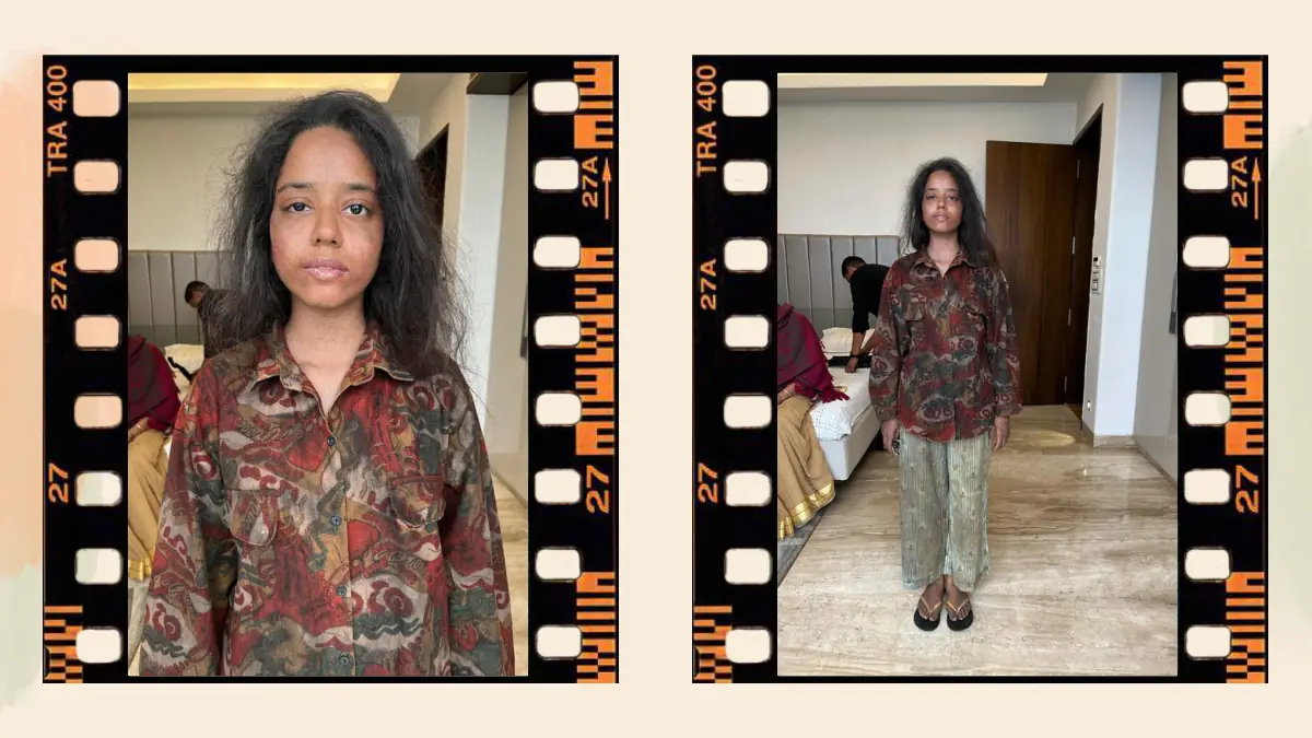 Prosthetic Work portfolio page 48