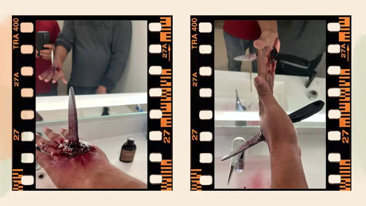 Prosthetic Work portfolio page 50