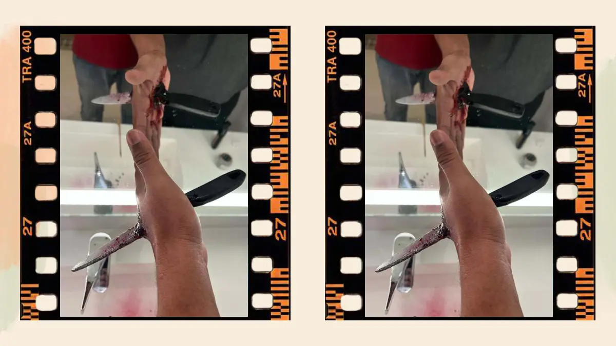 Prosthetic Work portfolio page 51