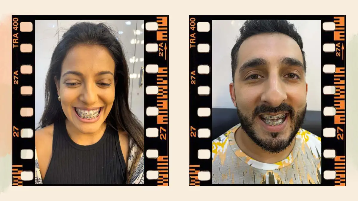 Prosthetic Work portfolio page 54